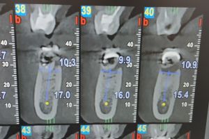 IMG_20190312_125337-41-300-200-80-c