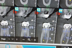 IMG_20190312_125345-42-300-200-80-c