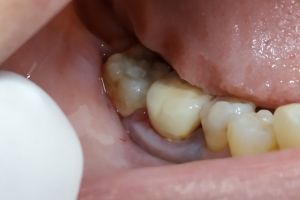 IMG_20190312_125419-39-300-200-80-c