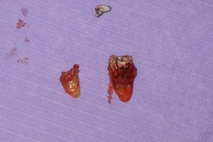 IMG_20190312_130347-31-300-200-80-c