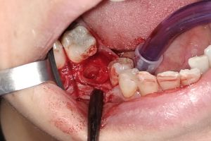 IMG_20190312_131233-32-300-200-80-c