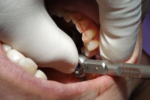 IMG_20190312_132731-34-300-200-80-c