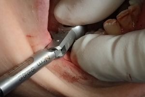 IMG_20190312_132845-36-300-200-80-c