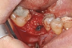 IMG_20190312_134017-38-300-200-80-c