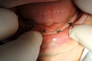 IMG_20200218_090609-16-300-200-80-c