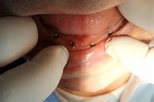 IMG_20200218_090613-17-300-200-80-c