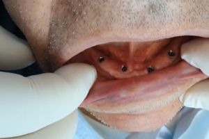 IMG_20200218_090623-18-300-200-80-c