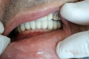 IMG_20200218_093137-20-300-200-80-c