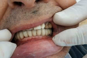 IMG_20200218_093146-21-300-200-80-c