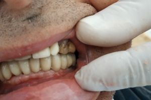 IMG_20200218_093149-22-300-200-80-c